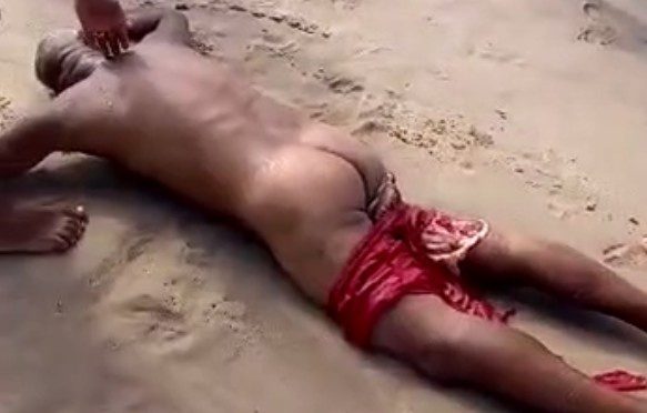 Shark Attack Survivor