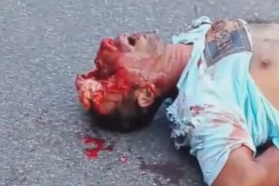 Traffic Accident Left Man With Head Destroyed