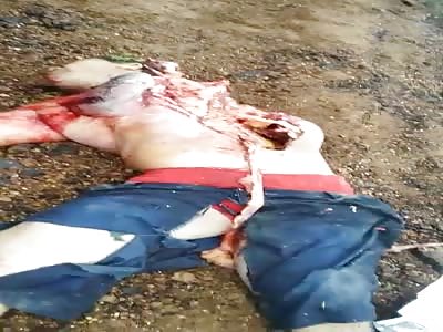 GORE ... Man's Chest Split Open after Horrific Accident 