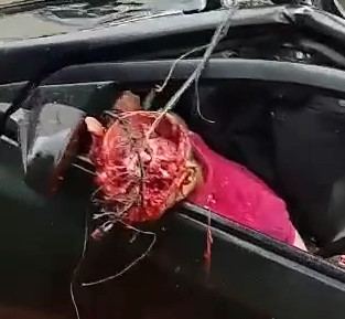 Horrific Accident in Brazil leaves Person Headless