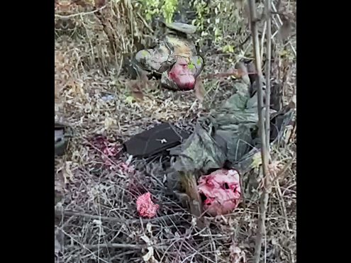 Intact Russian Brain Half Popped Out from Skull