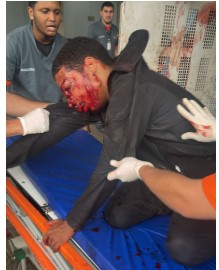 A bandit was shot in the head by his own accomplice during a robbery i