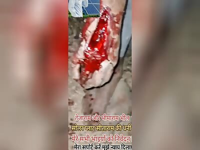  INJURIES SUFFERED AT WORK