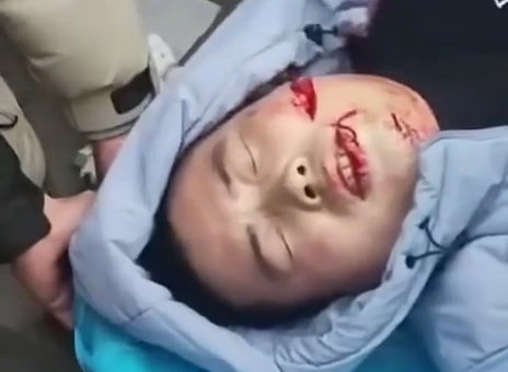 Two Chinese man stabbed and face slashed after argument with lunatic 