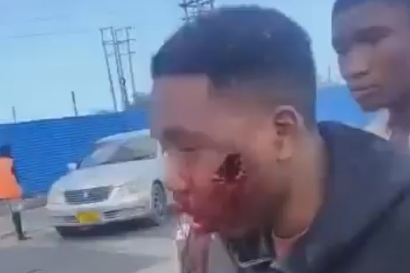 Man Involved In Protests Shot In The Face By Police