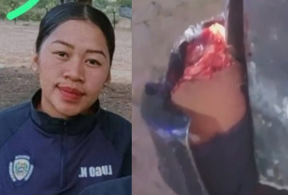 Female Police Officer Lost Leg In Traffic Accident