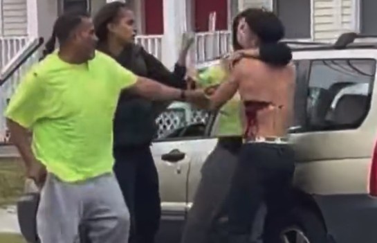 Man Gets Stabbed During Street Fight In Connecticut