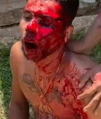 Man Slashed In Face With Machete