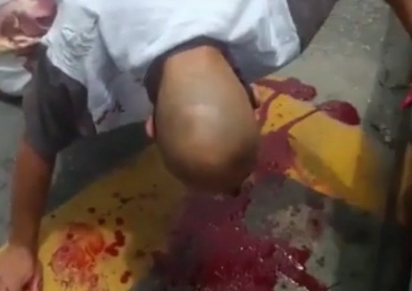 Someone Stuck A Knife In His Eye