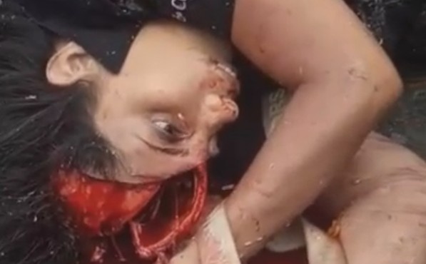 Graphic Aftermath Of Traffic Accident In Ecuador