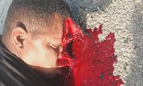 Man Seriously Injured In Traffic Accident