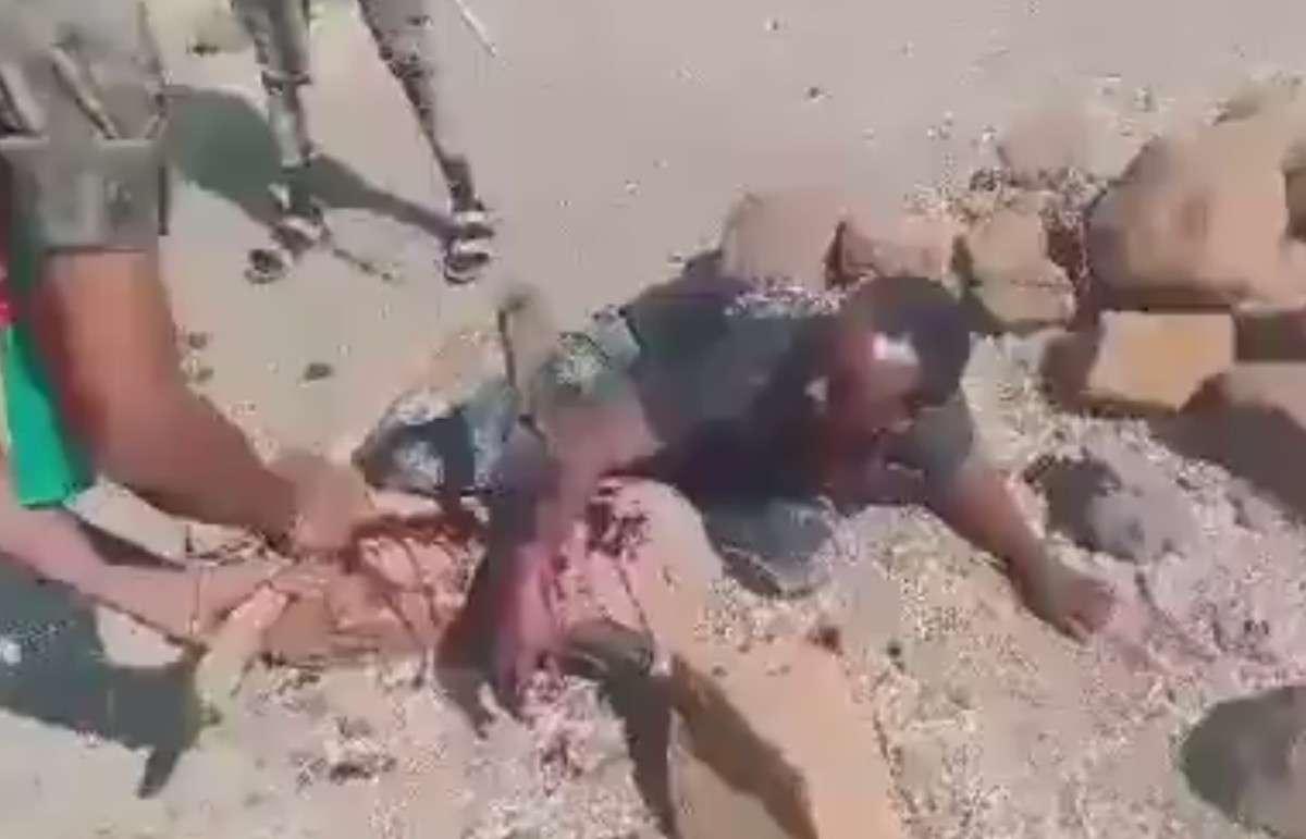 Civilian Gets Hand Shopped Off By Soldiers In Ethiopia