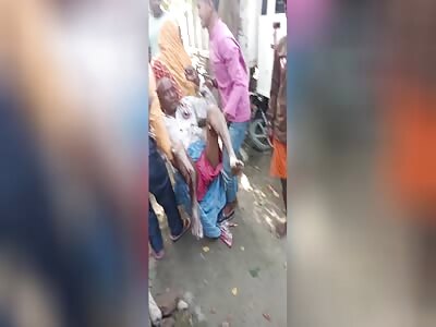 GRANDPA'S LEG IS FUCKED UP