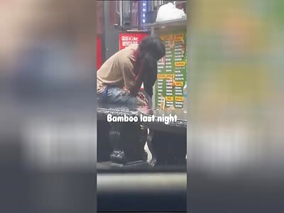 HE GET THE FACE CHOP WAY AND THE FINGERS TOO