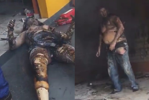 Jelious Man Set Wife Ablaze Causing House Fire