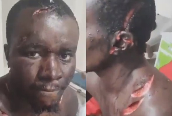 Machete Attack Survivor