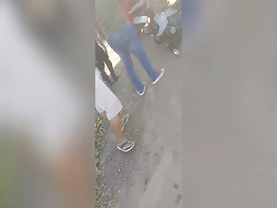 Man loses leg in moto accident