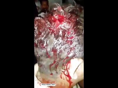 The shadow of the pursuit