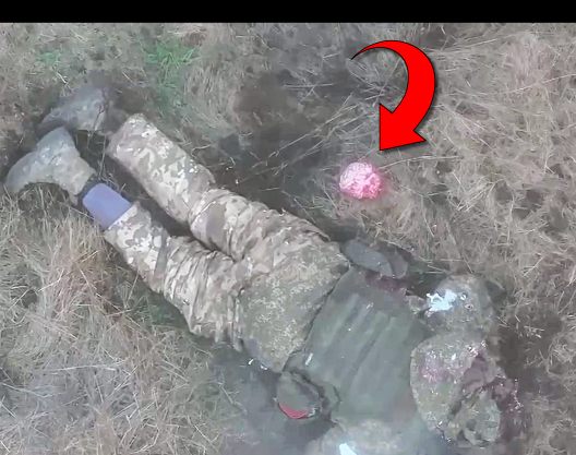 Intact But Neglected Russian Brain Ejects from Skull (HQ Ed.)