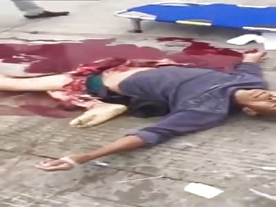 Man's Lower Body Crushed During Accident ***GRAPHIC***