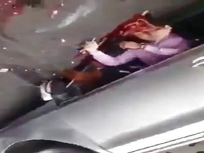 Accident Leaves Brains Smeared All Over The Road