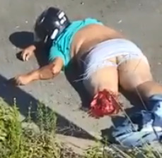 Onlooker Records The Graphic Aftermath Of A Fatal Accident