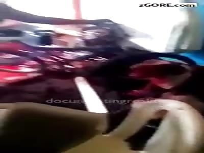 face disfigured by dog â€‹â€‹attack