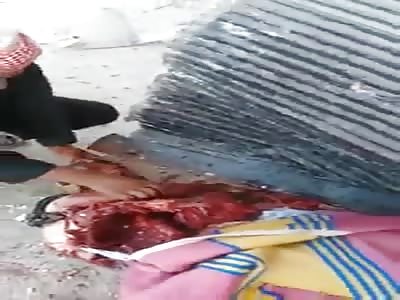 Two men shattered by Aleppo bombings