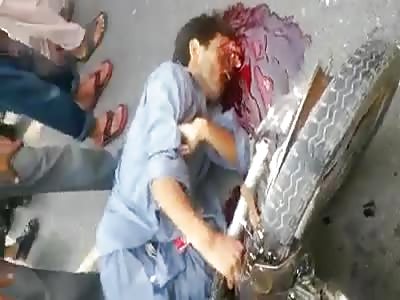 Man with serious injury after accident