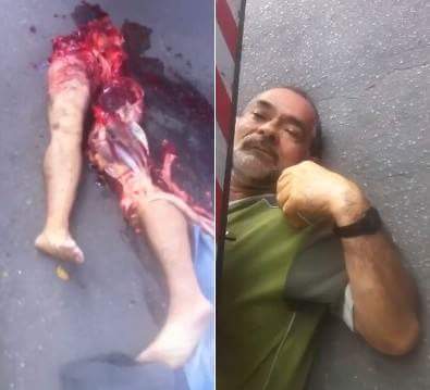 Man suffers a terrible accident (better quality)