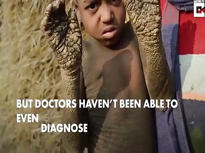 Ã·Boy from bangladesh with terrible disease and. I felt a lot of pain