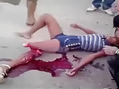 Woman loses her leg in accident