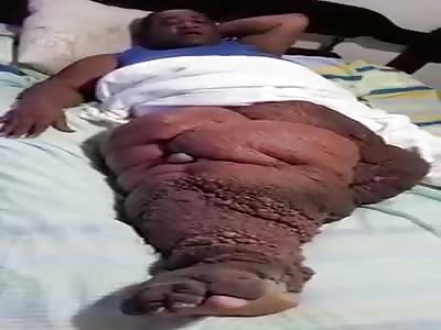 Man with severe leg disease begs for help health authorities