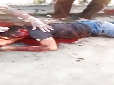 Man dying while taking several shots