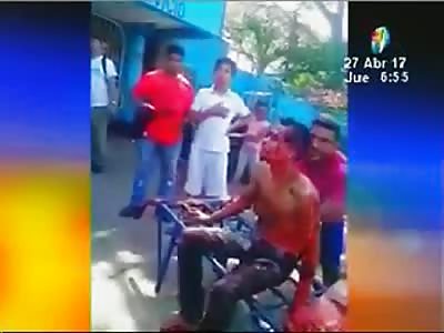 Young boy shot waiting for help supported by population