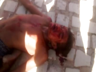 A man dying after being beaten.