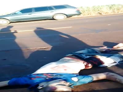 Accident. Man loser foot