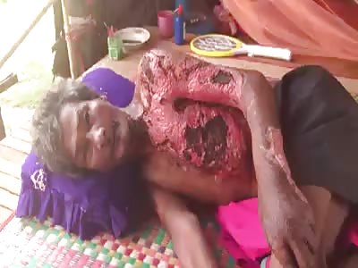 Man with horrible disease