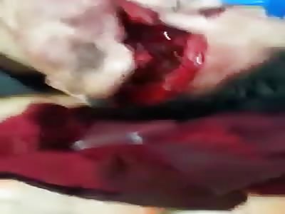 Shock: Terrible open face and talking with doctors