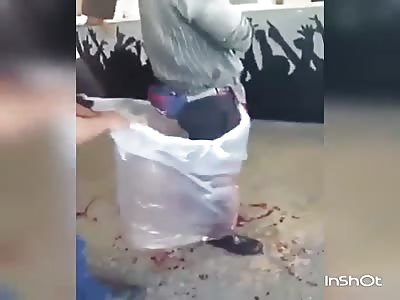 Man loses his arm in a fight with a faction