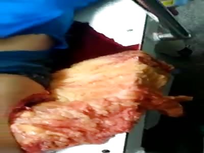 Man takes shot of belly rifle