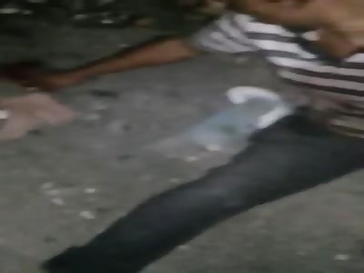 Man has fingers cut with machete in favela