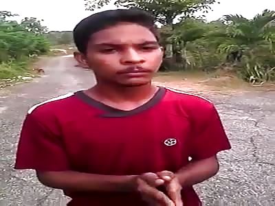 Thief take shots on both hands and leg