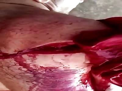 Rapist was brutally attacked with machete