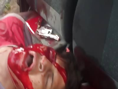 Agonizing with several shot 