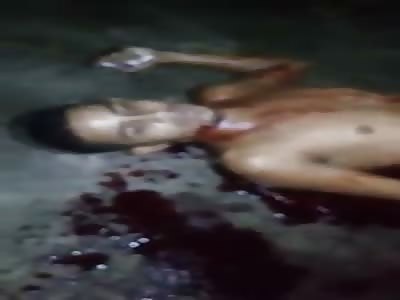 Agonizing Man shot Multiple Times Just Waits to Die