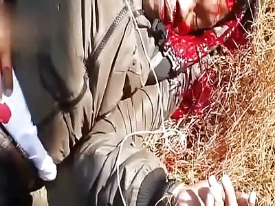 agonizing after accident and vomiting blood too horrible 