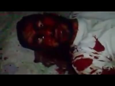 Man shot by Syrian army.