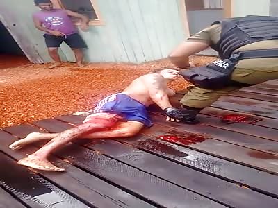 Injured man hit by cop