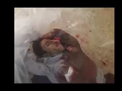 Face destroyed  in war